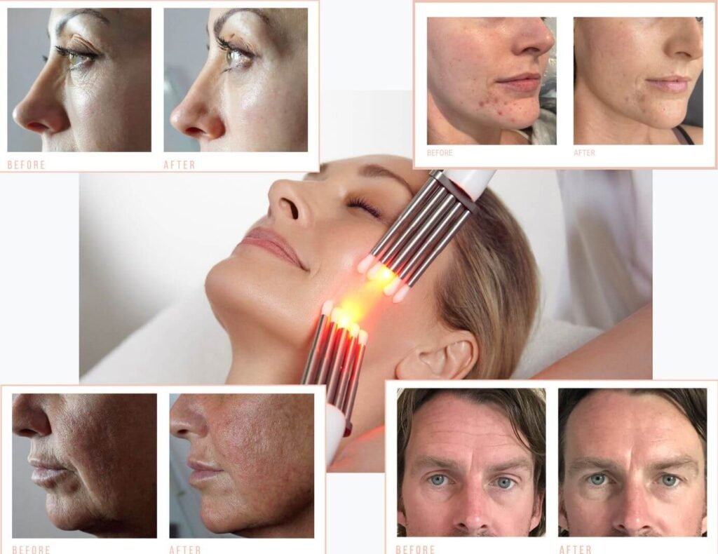 Collage of before and After shots showing the effectiveness of CACI's anti ageing treatments